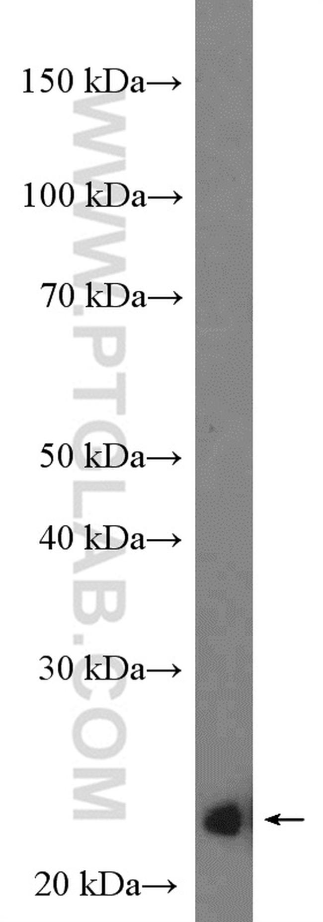 P27/KIP1 Antibody in Western Blot (WB)