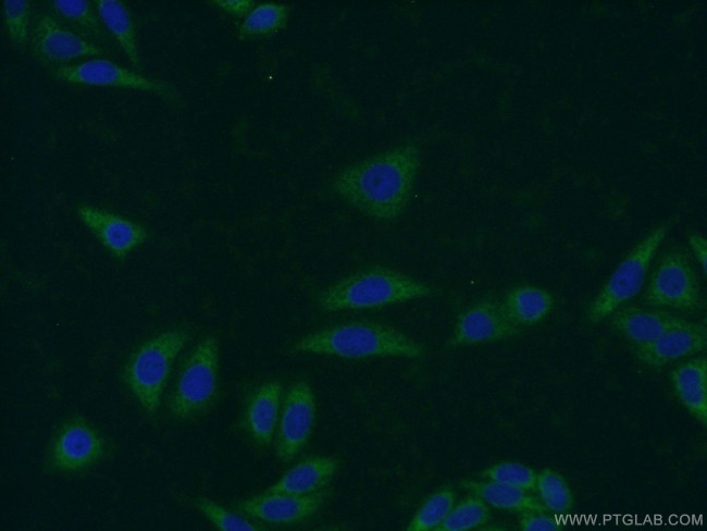 C19orf36 Antibody in Immunocytochemistry (ICC/IF)