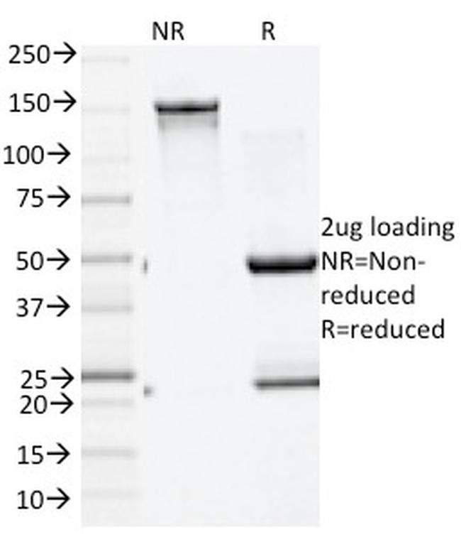 GAD2/GAD65 Antibody in SDS-PAGE (SDS-PAGE)