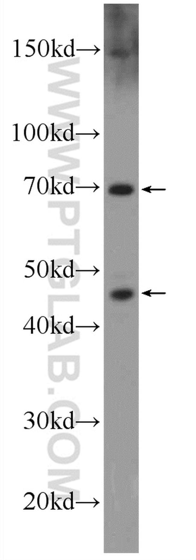 SETMAR Antibody in Western Blot (WB)
