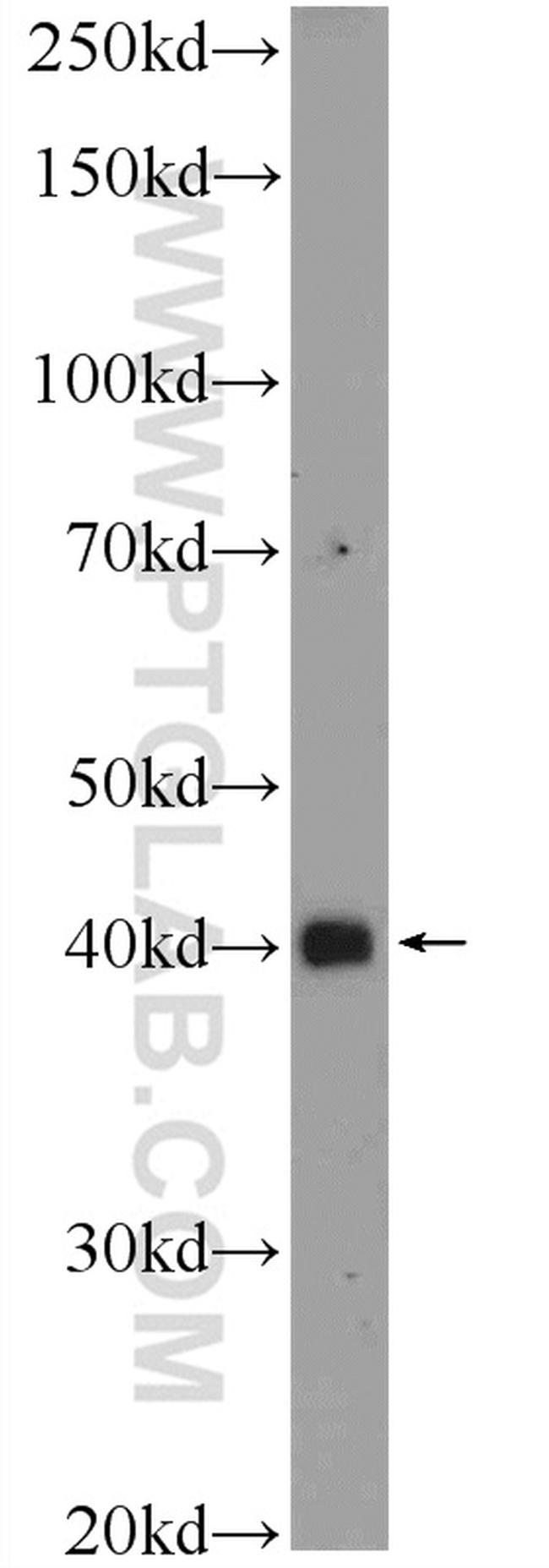 SMAD7 Antibody in Western Blot (WB)