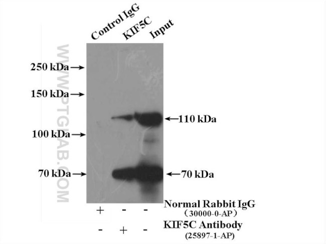 KIF5C Antibody in Immunoprecipitation (IP)