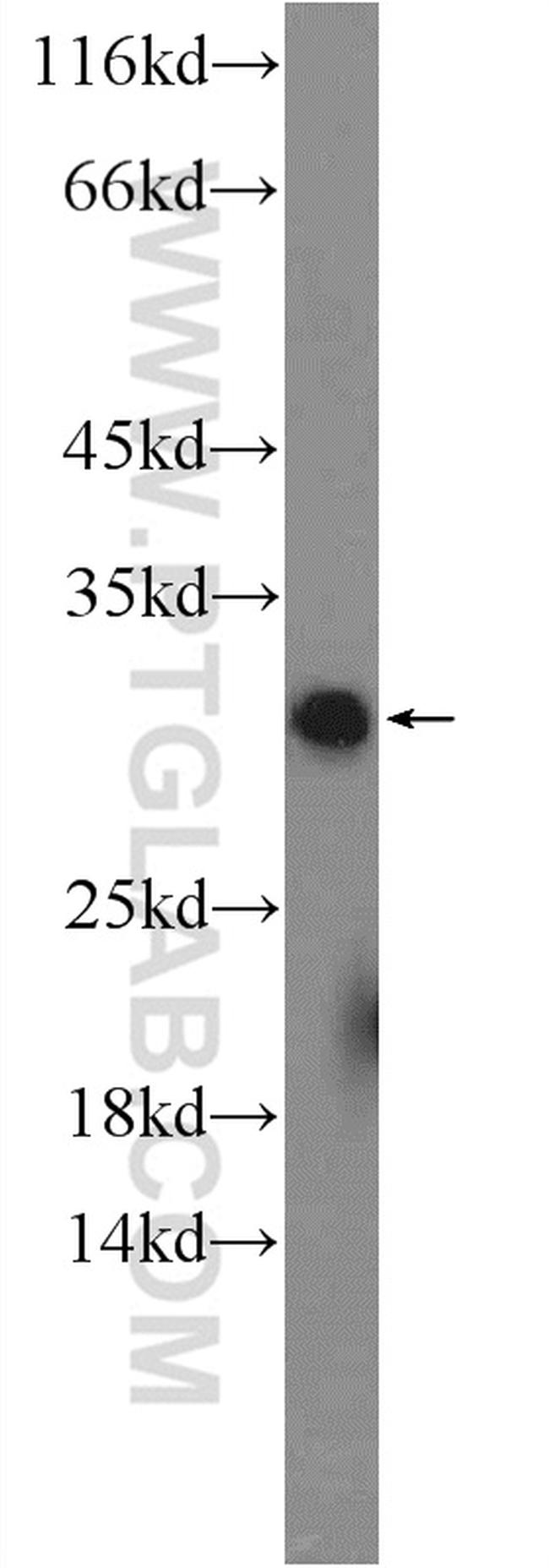 RNF141 Antibody in Western Blot (WB)