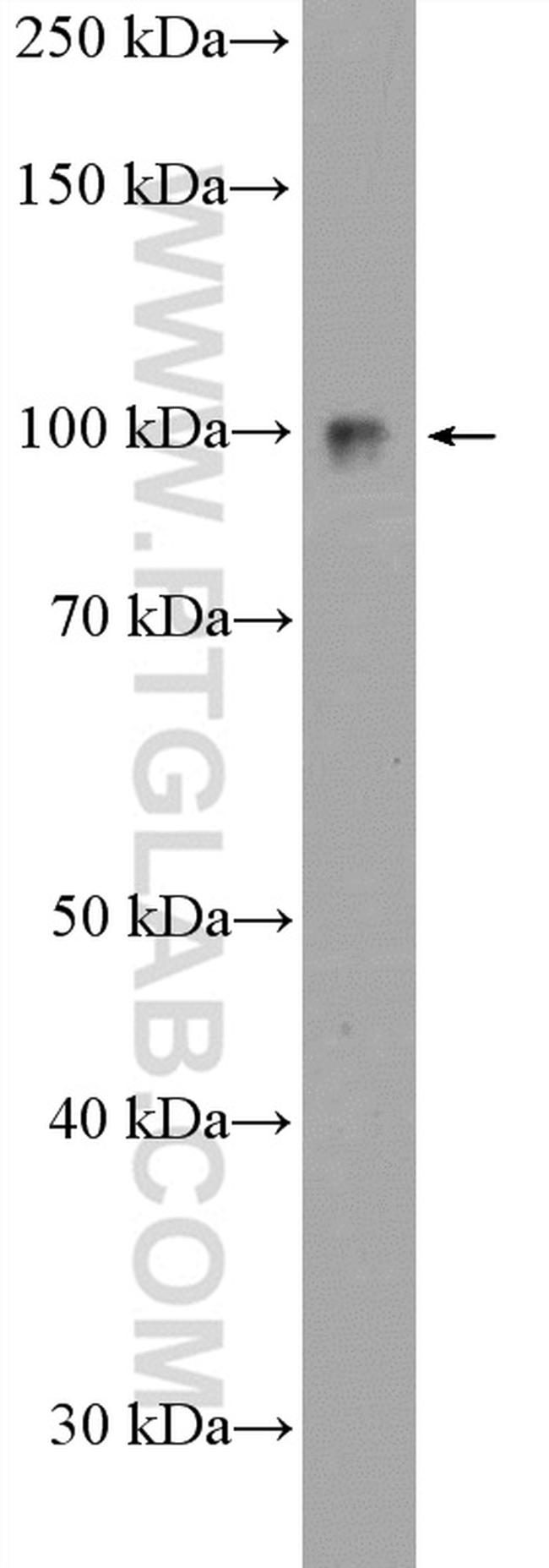 KIAA0776 Antibody in Western Blot (WB)