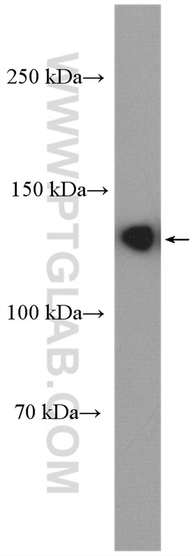 ECE1 Antibody in Western Blot (WB)