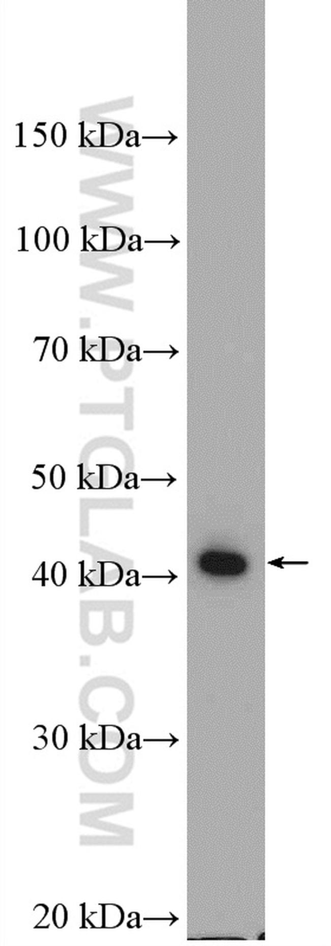 ABHD1 Antibody in Western Blot (WB)