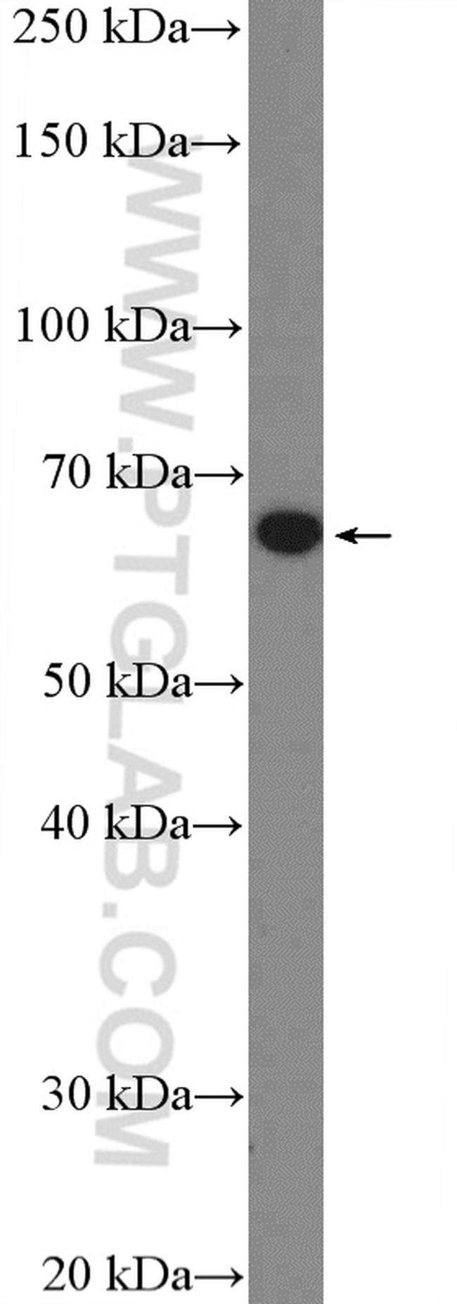 MBTD1 Antibody in Western Blot (WB)