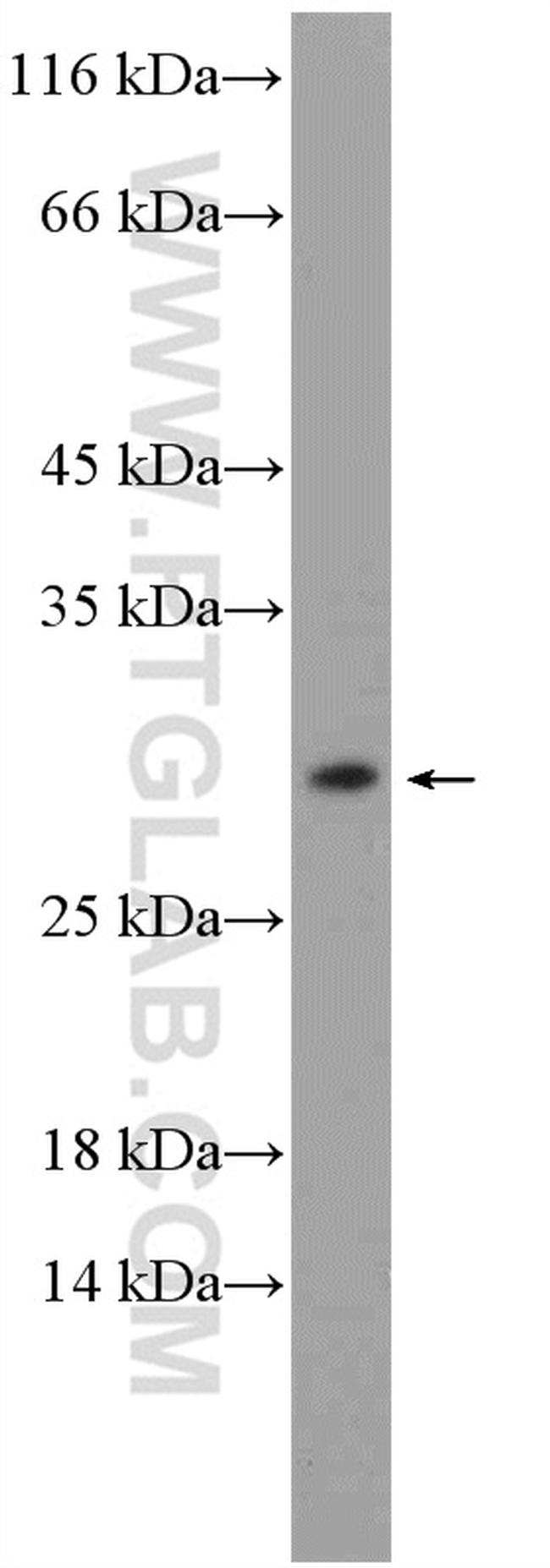 MOSPD3 Antibody in Western Blot (WB)