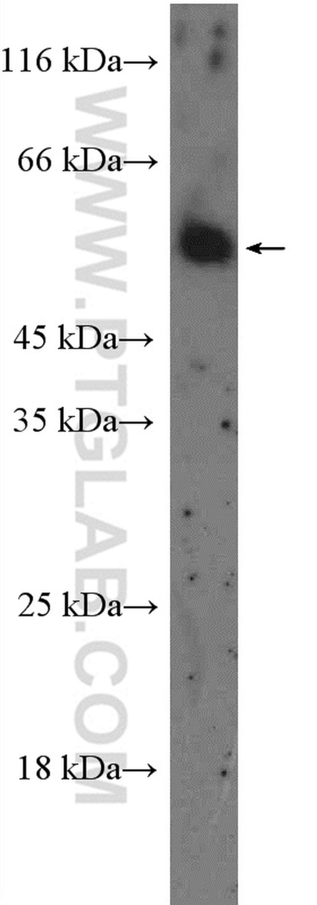 HTR2B Antibody in Western Blot (WB)