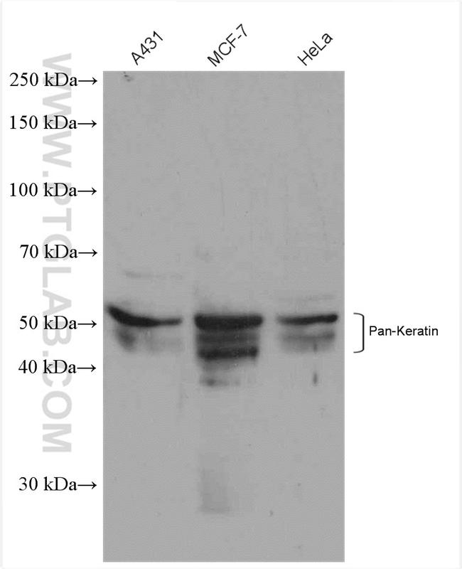 pan-keratin Antibody in Western Blot (WB)