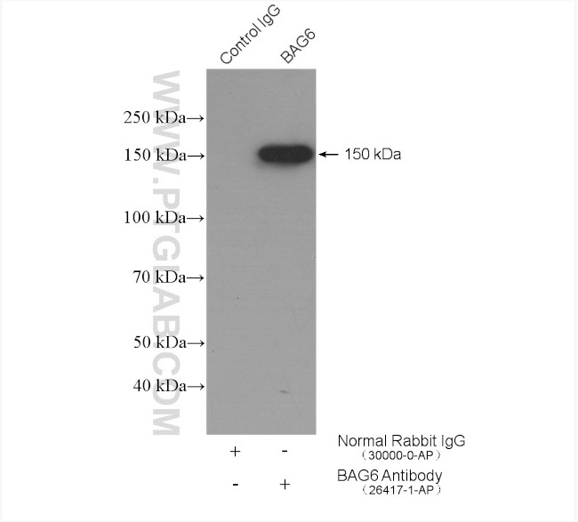 BAG6 Antibody in Immunoprecipitation (IP)