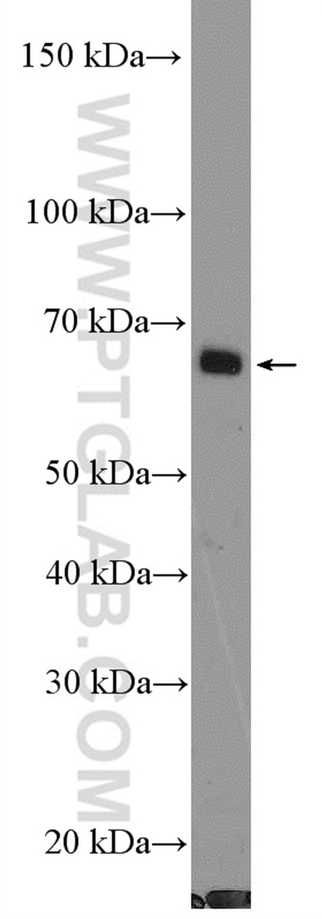 PPM1D Antibody in Western Blot (WB)