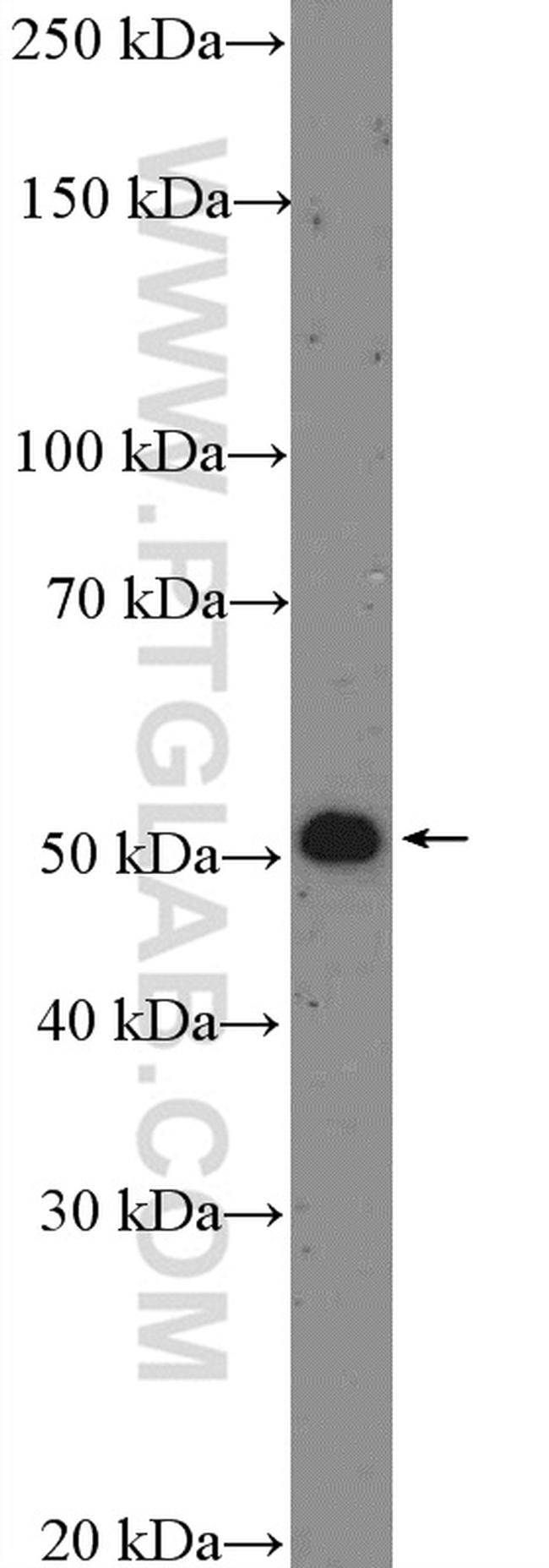 p70(S6K) Antibody in Western Blot (WB)