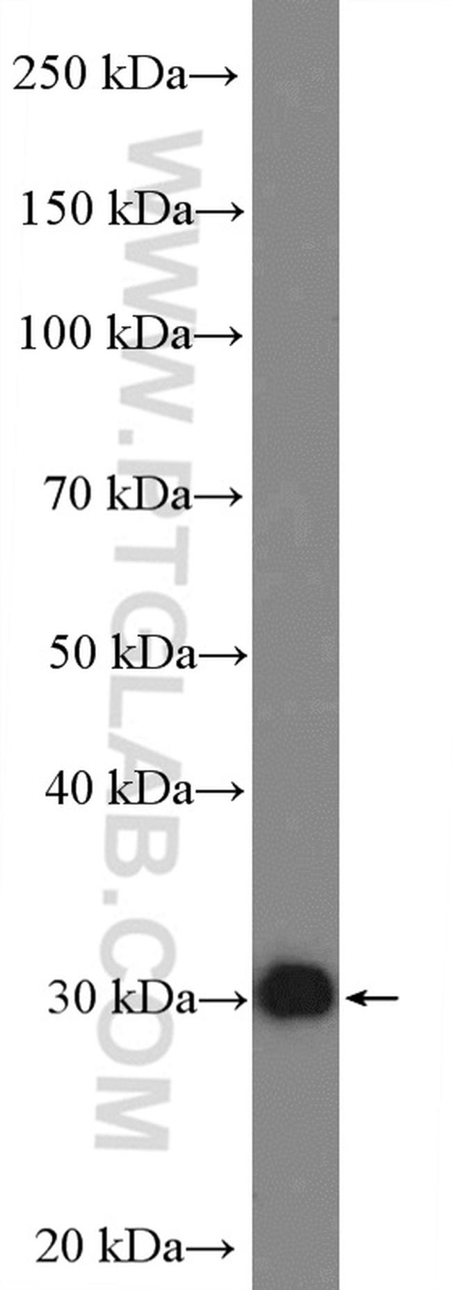 TP53RK Antibody in Western Blot (WB)
