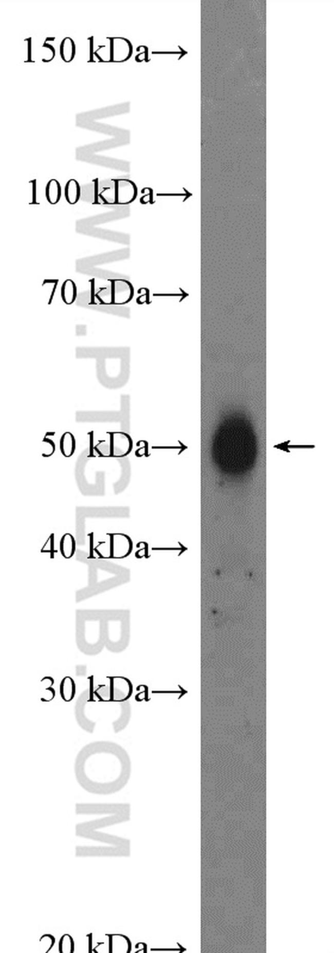 FAM175B Antibody in Western Blot (WB)