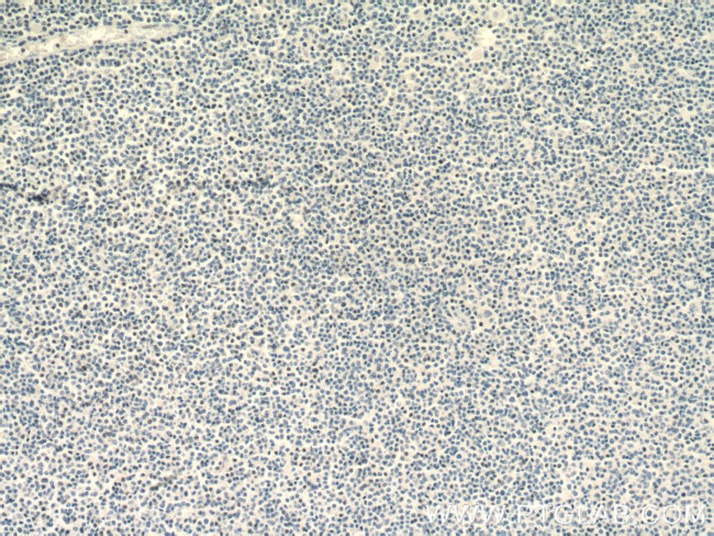 TLX1 Antibody in Immunohistochemistry (Paraffin) (IHC (P))