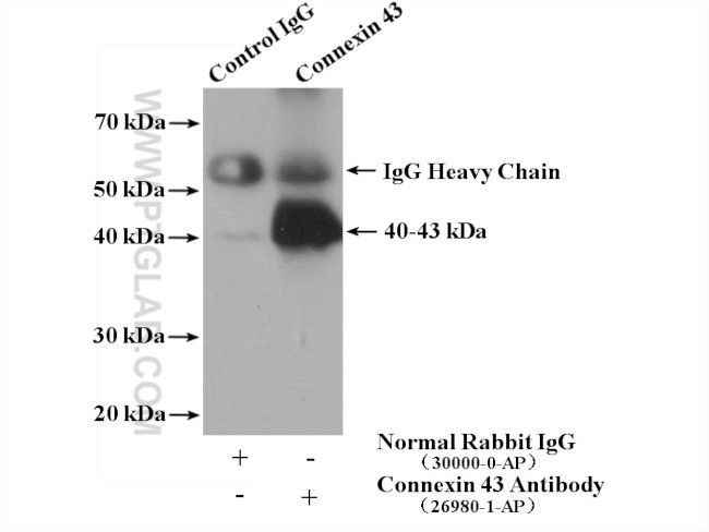 Connexin 43 Antibody in Immunoprecipitation (IP)