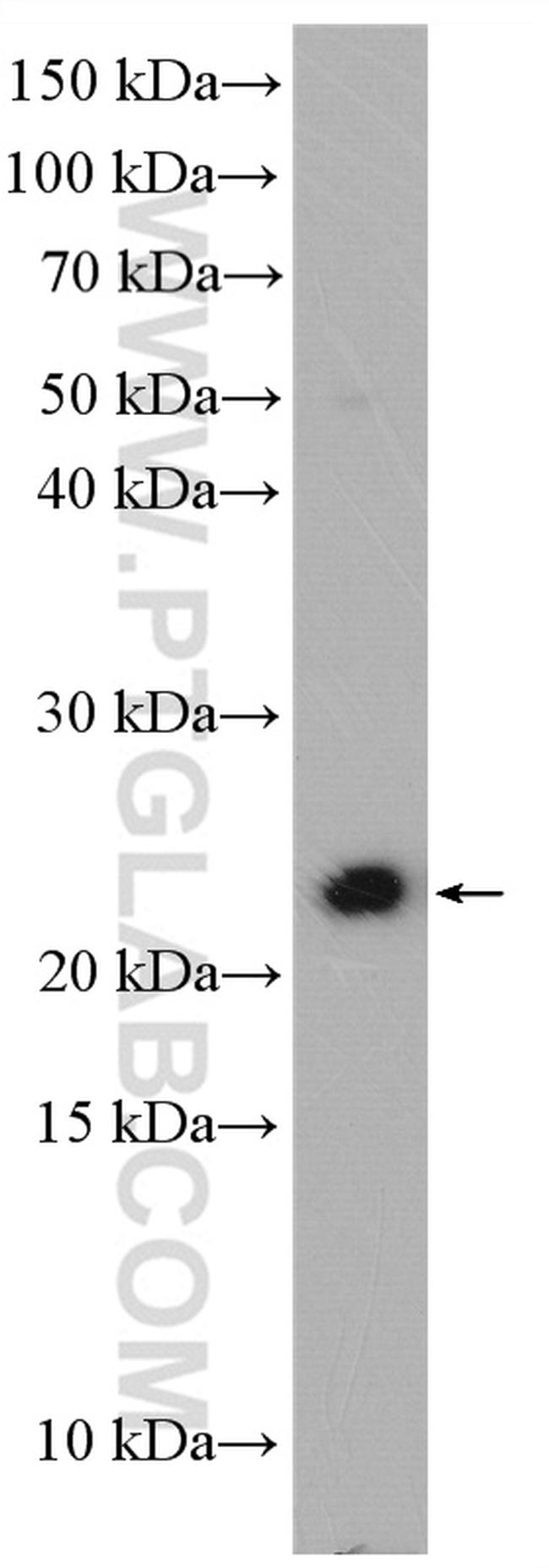 LCN2 Antibody in Western Blot (WB)