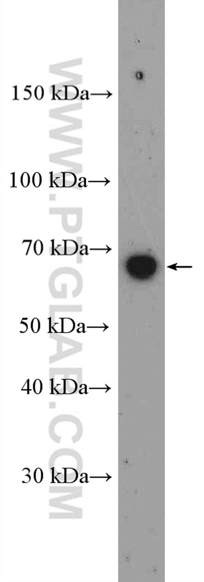 LRRTM3 Antibody in Western Blot (WB)