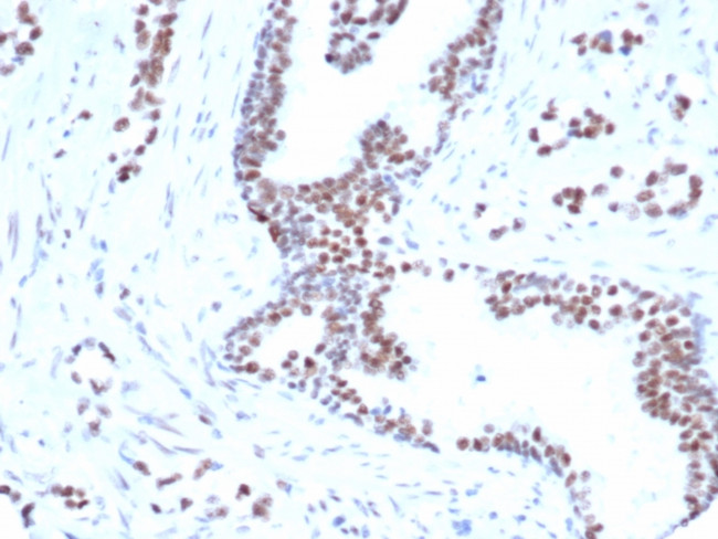FOXP1 (Transcription Factor) Antibody in Immunohistochemistry (Paraffin) (IHC (P))