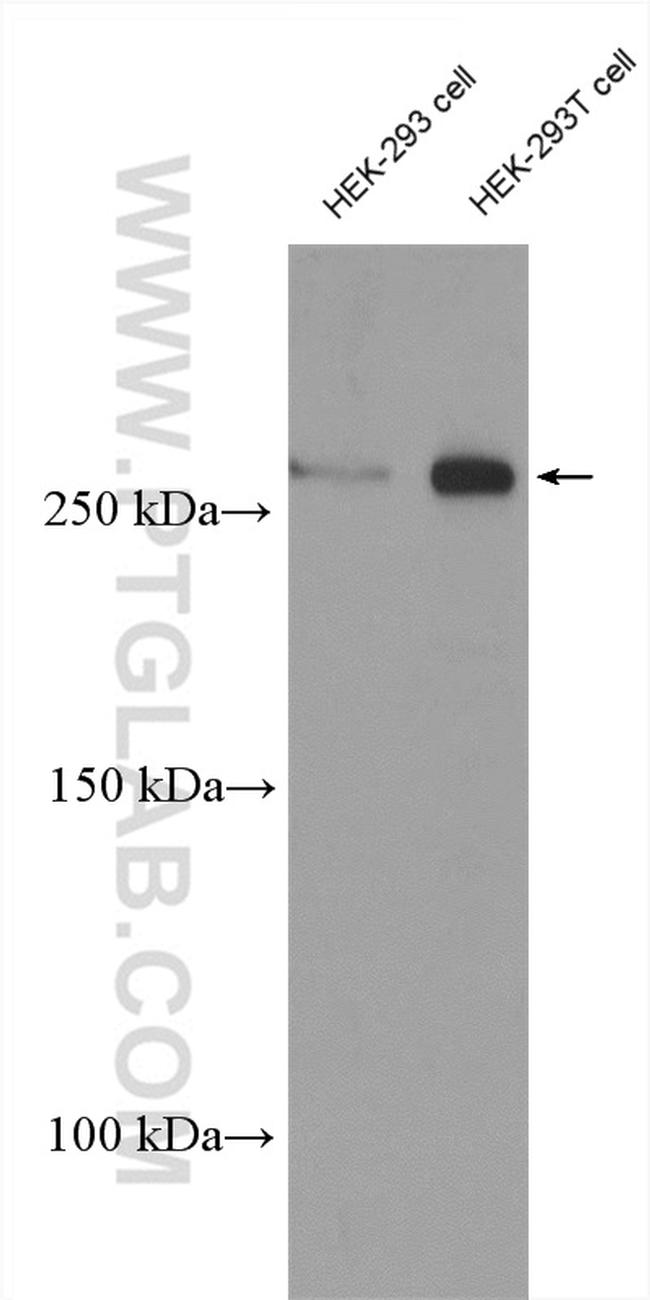 Neurofibromin Antibody in Western Blot (WB)
