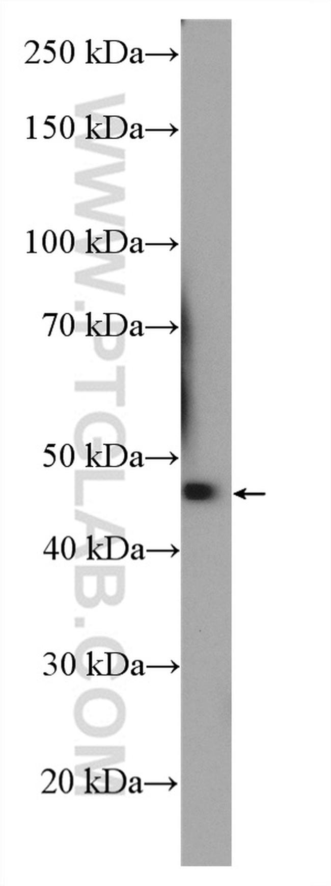 KLHDC1 Antibody in Western Blot (WB)