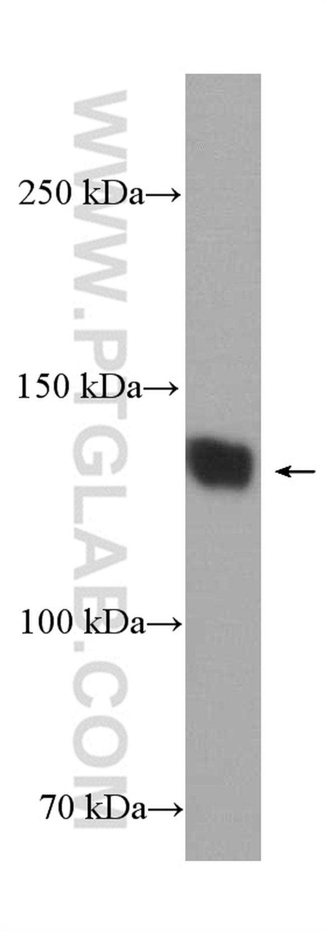 CACNA2D1 Antibody in Western Blot (WB)