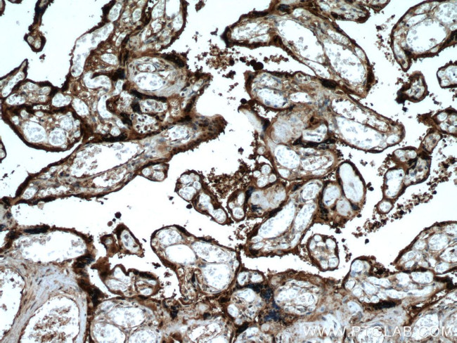 HSD17B1 Antibody in Immunohistochemistry (Paraffin) (IHC (P))