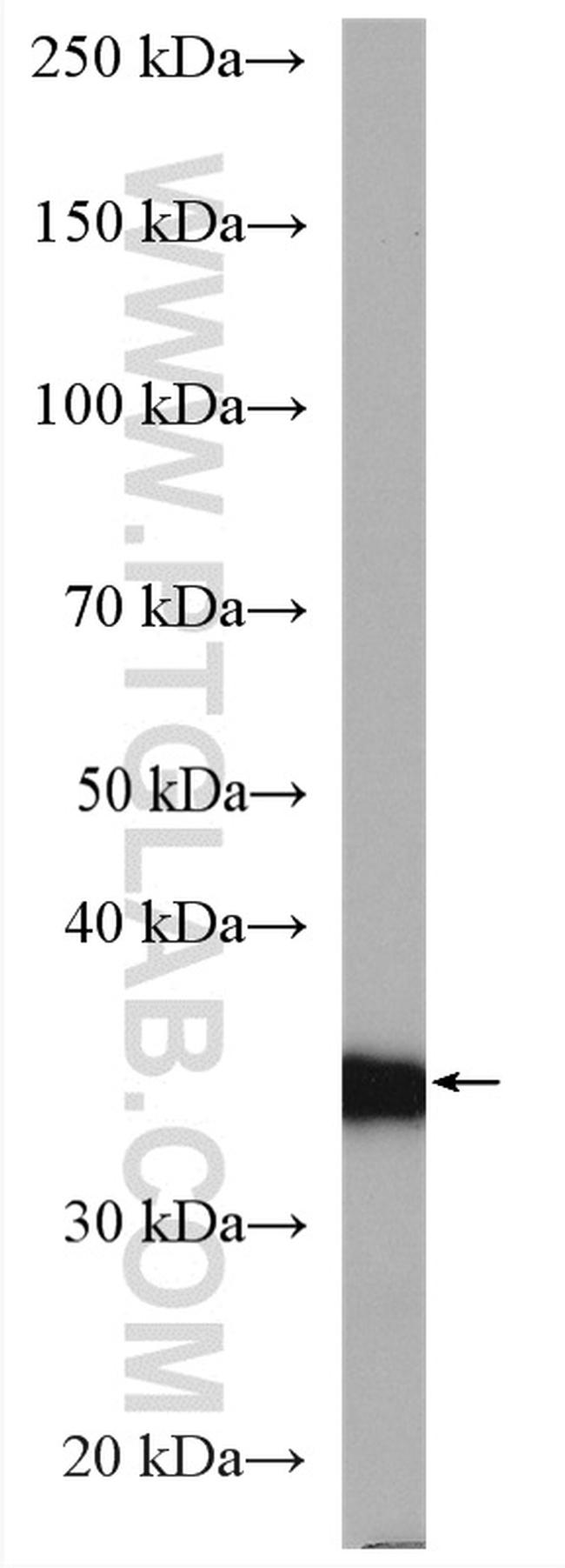 HSD17B1 Antibody in Western Blot (WB)