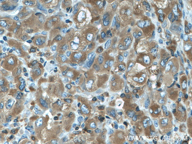 FMNL1 Antibody in Immunohistochemistry (Paraffin) (IHC (P))