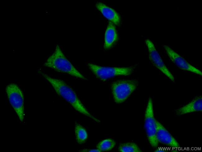 ATP1A3 (middle) Antibody in Immunocytochemistry (ICC/IF)
