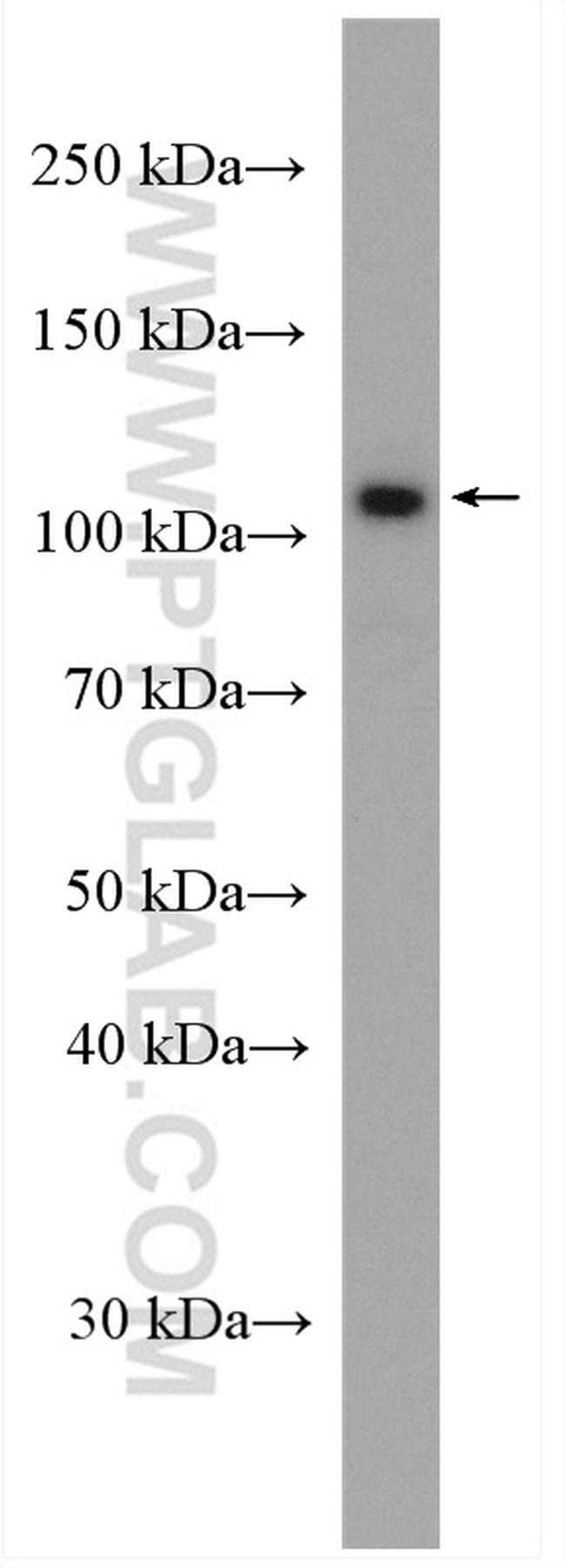 ATP1A3 (middle) Antibody in Western Blot (WB)