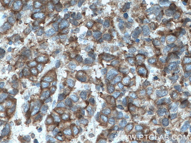 ATP1A3 (middle) Antibody in Immunohistochemistry (Paraffin) (IHC (P))