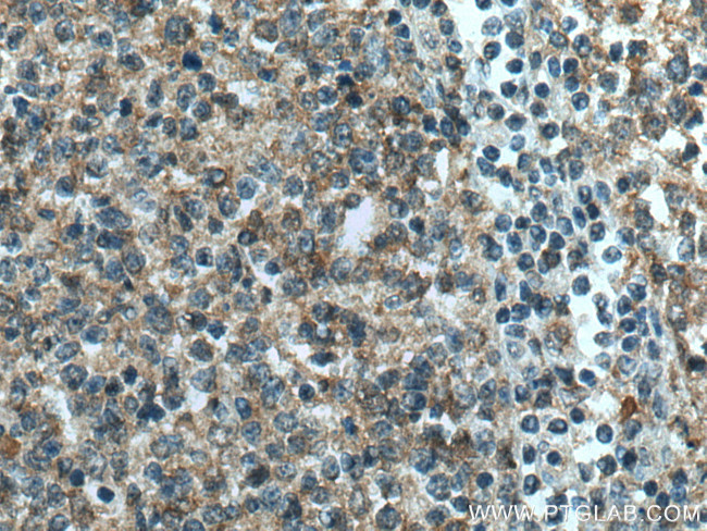 IL-4R Antibody in Immunohistochemistry (Paraffin) (IHC (P))