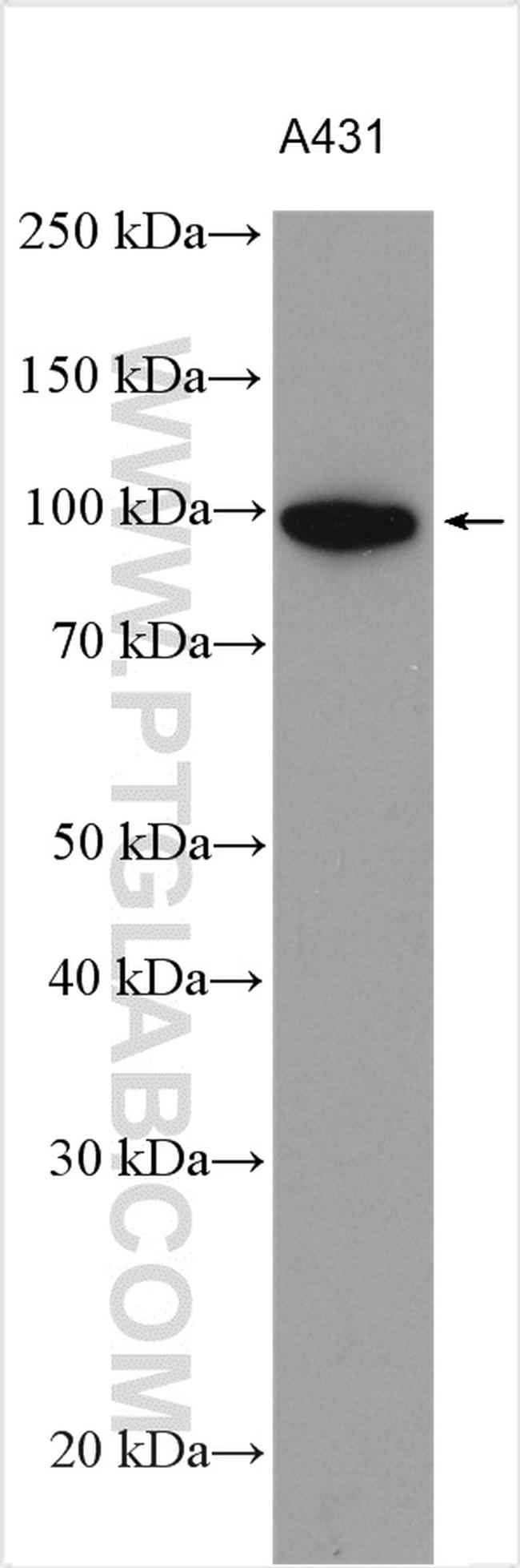 Integrin beta-6 Antibody in Western Blot (WB)