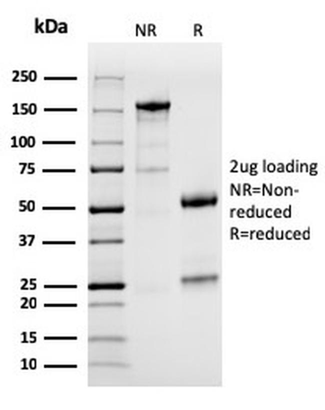 PD-L1/PDCD1LG1/CD274/B7-H1 (Cancer Immunotherapy Target) Antibody in SDS-PAGE (SDS-PAGE)