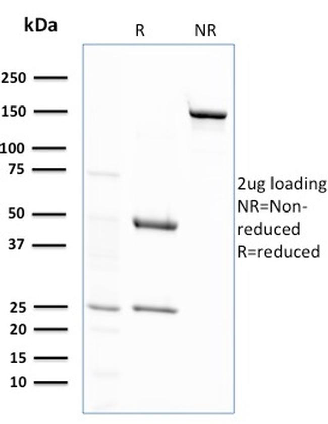 Glutathione S-Transferase Mu2 (GSTM2) Antibody
