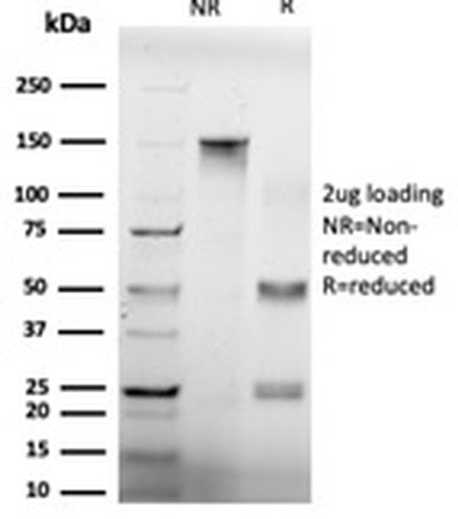 GTF2H2/BTF2/TFIIH Basal Transcription Factor Antibody in SDS-PAGE (SDS-PAGE)