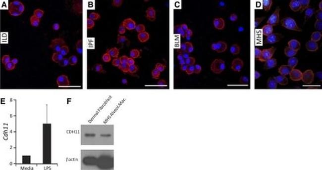CDH11 Antibody in Western Blot, Immunohistochemistry (WB, IHC)