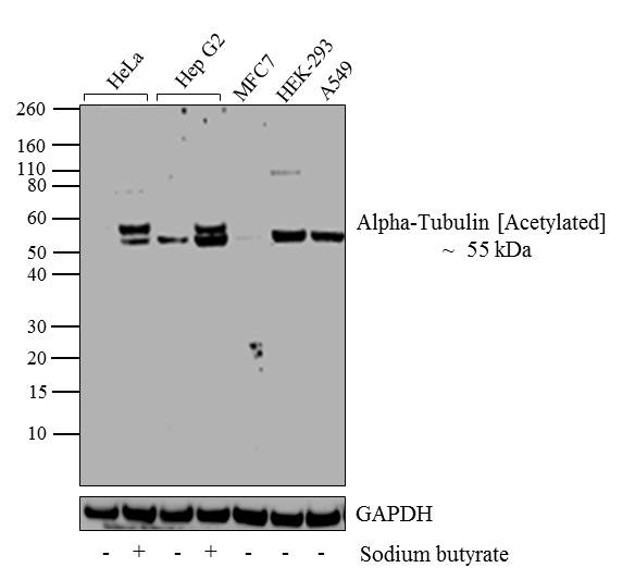 Acetyl-alpha Tubulin (Lys40) Antibody in Western Blot (WB)