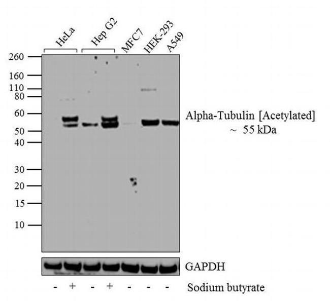 Acetyl-alpha Tubulin (Lys40) Antibody