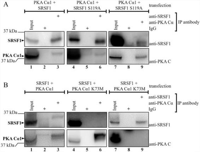 SRSF1 Antibody in Immunoprecipitation (IP)