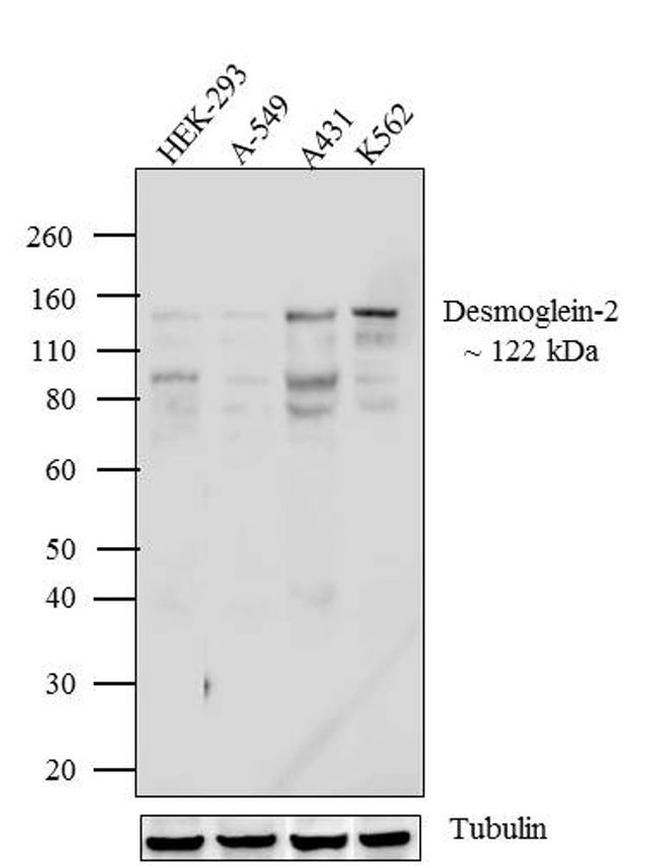 Desmoglein 2 Antibody in Western Blot (WB)