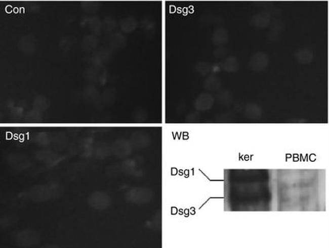 Desmoglein 3 Antibody in Western Blot, Immunocytochemistry (WB, ICC/IF)
