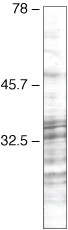 SRSF3 Antibody in Western Blot (WB)