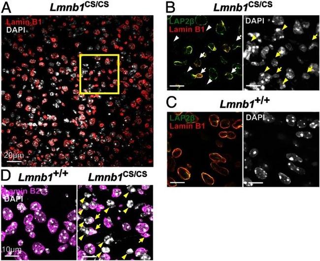 Lamin B2 Antibody in Immunocytochemistry (ICC/IF)