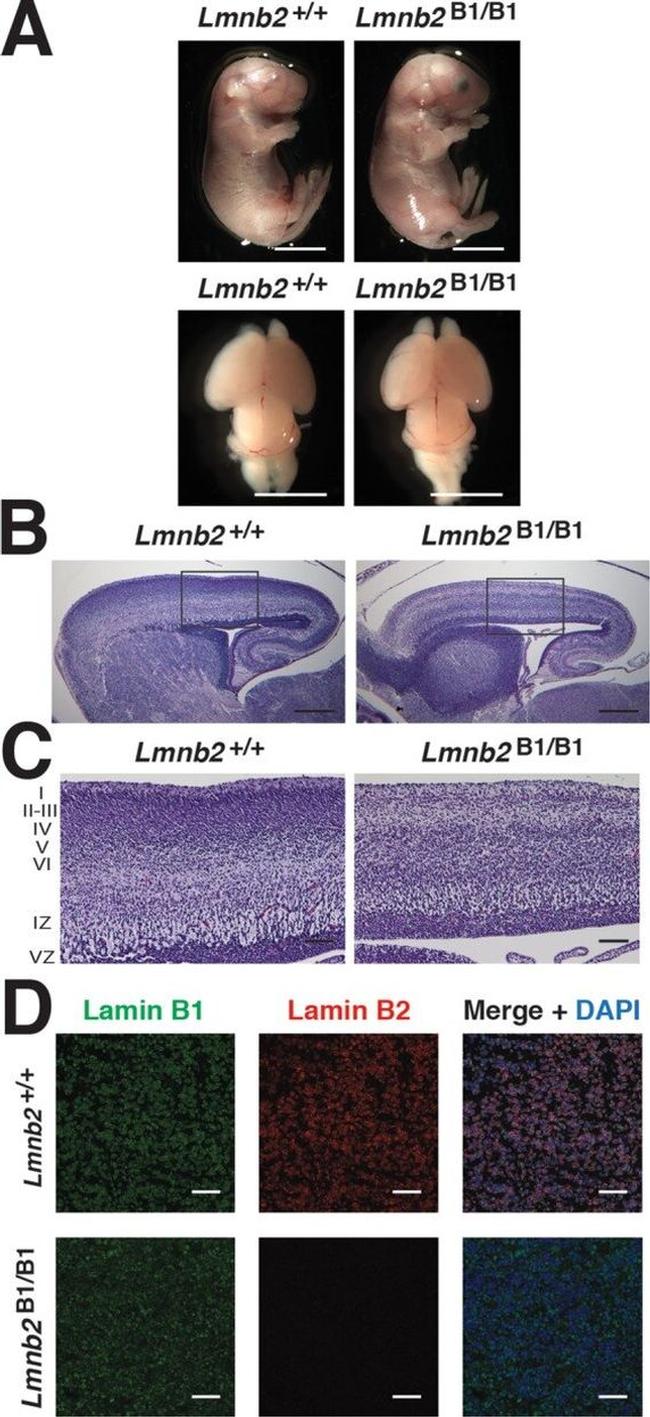 Lamin B2 Antibody in Immunohistochemistry (Paraffin) (IHC (P))