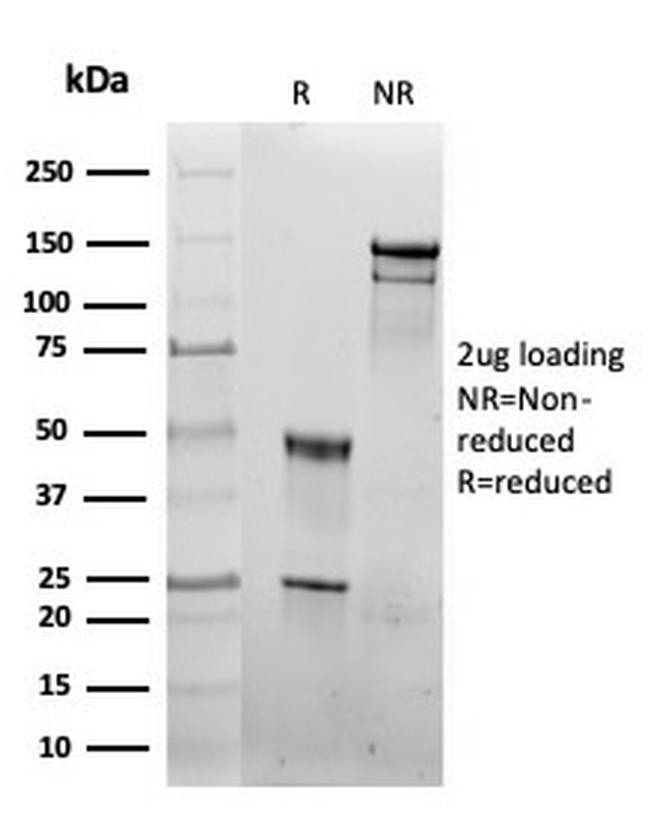 HSP60 (Heat Shock Protein 60) Antibody in SDS-PAGE (SDS-PAGE)