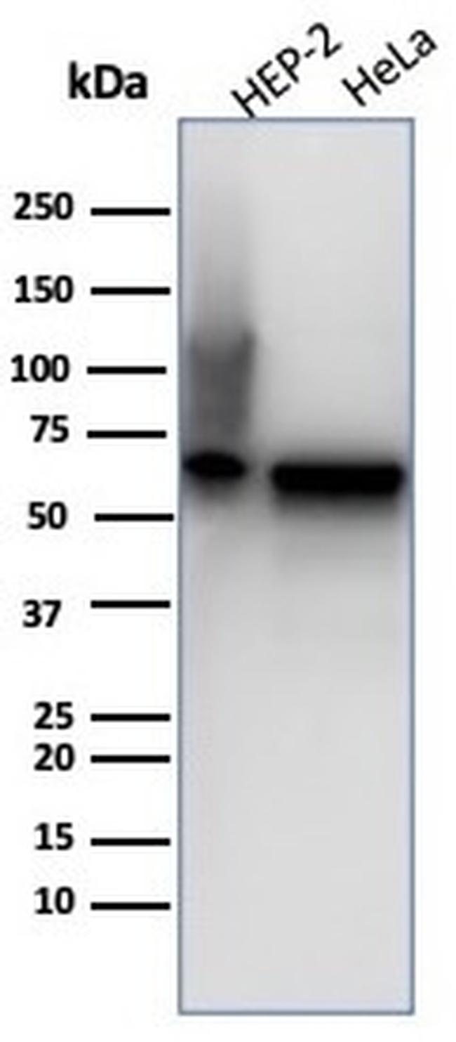 HSP60 (Heat Shock Protein 60) Antibody in Western Blot (WB)