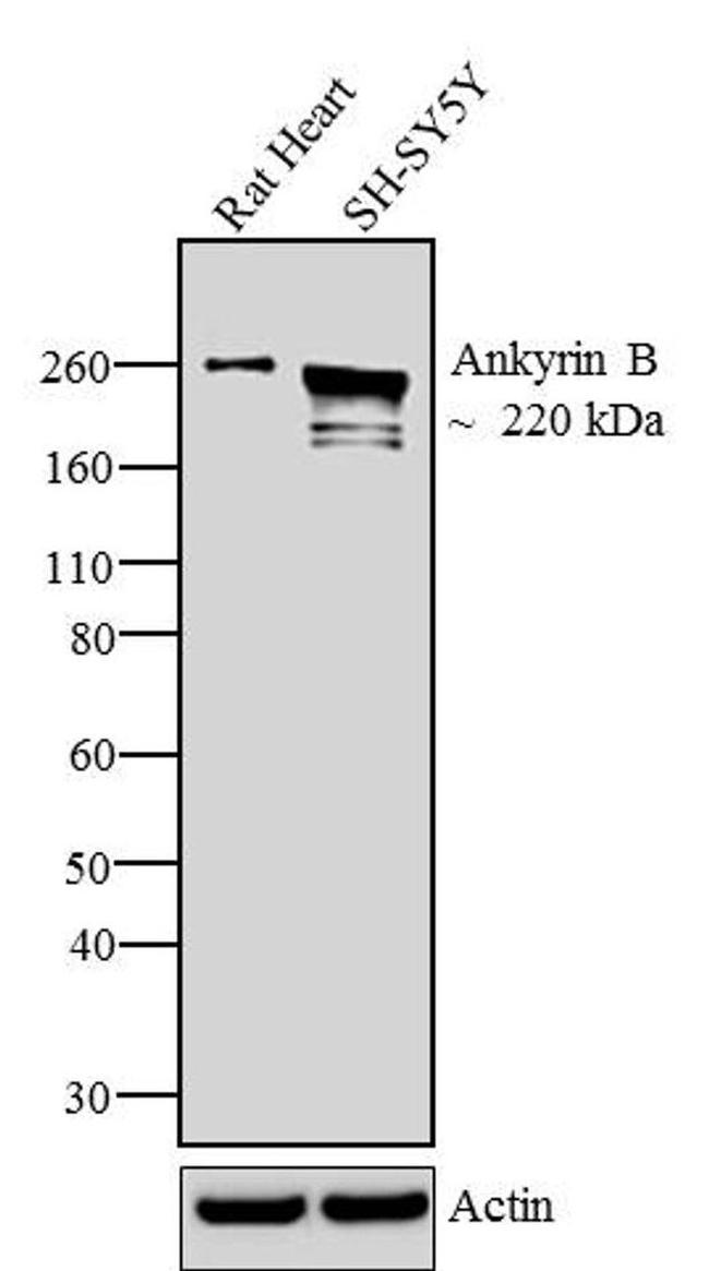 Ankyrin B Antibody in Western Blot (WB)